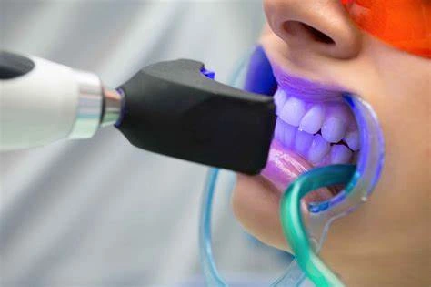 branqueamento dentário